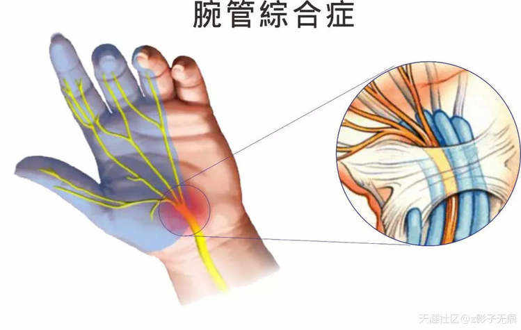 华为办公自带键鼠，为什么任正非说“工具不好累死人”？